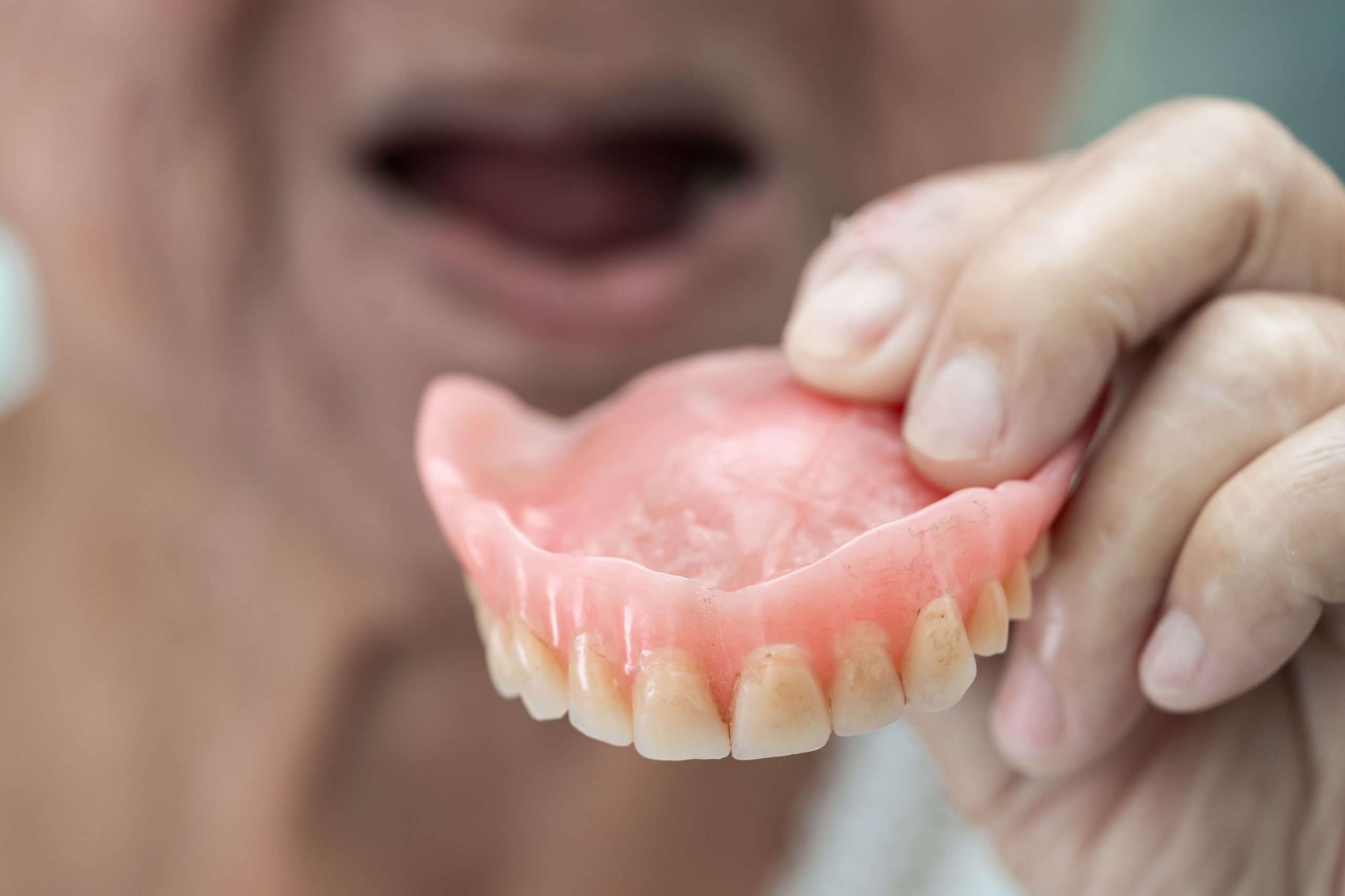Dental Implants