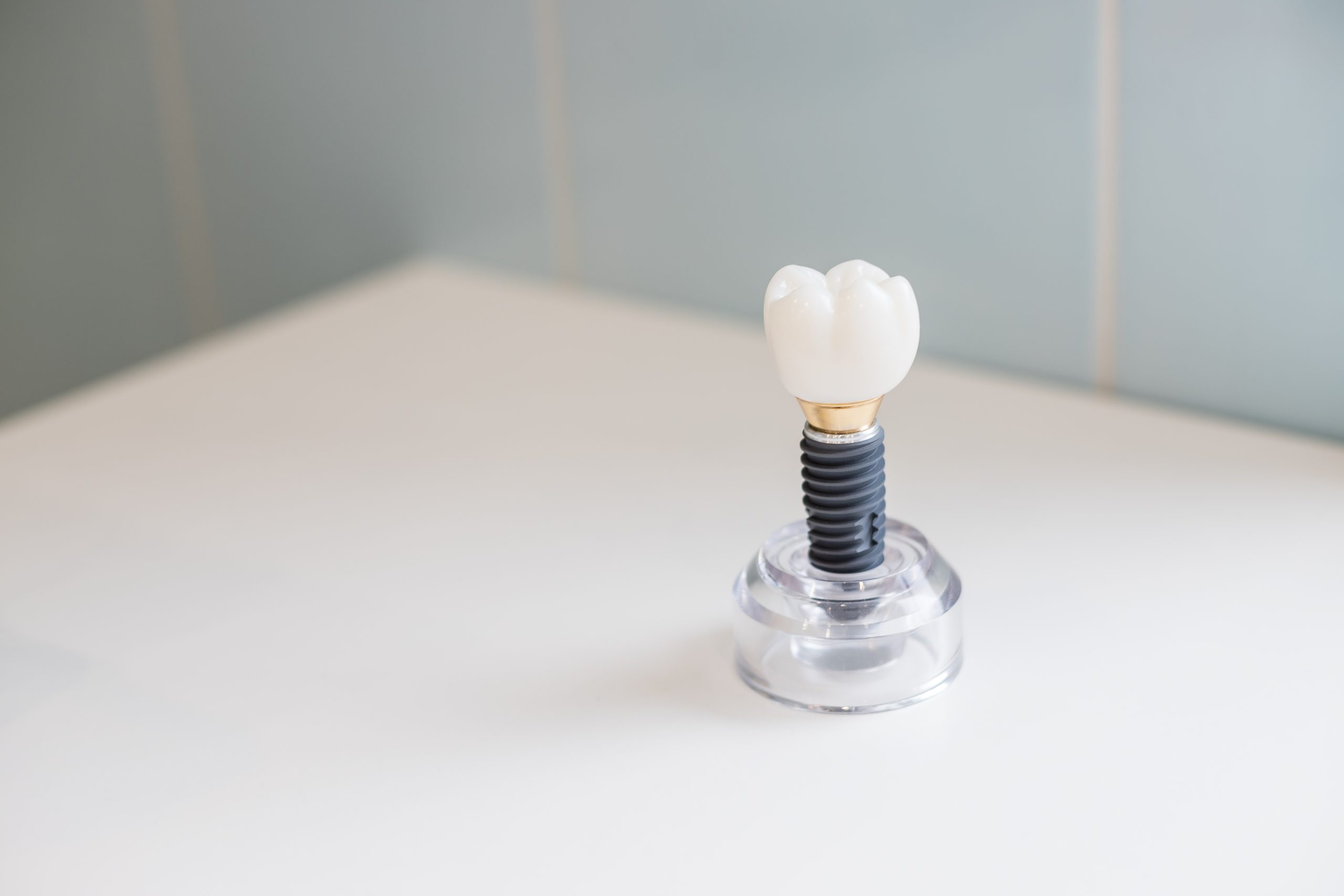 Articles Comparing Dental Implant Materials: