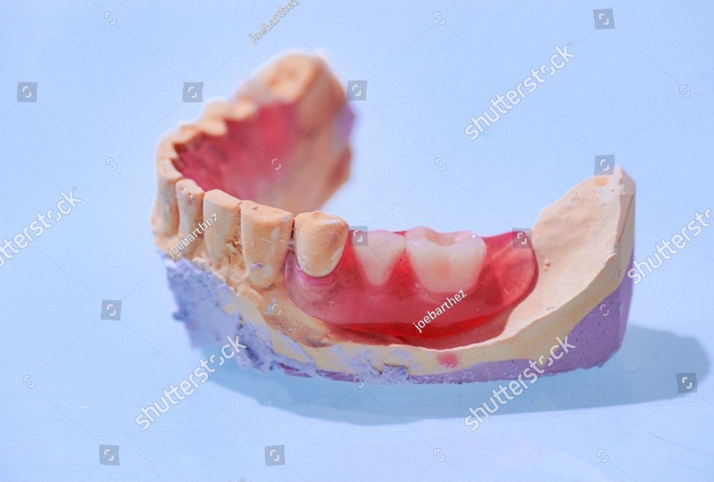 Articles All On Implants™ Costs In Australia: